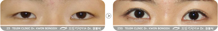 관련이미지