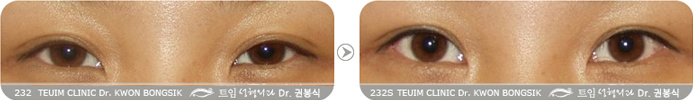 관련이미지